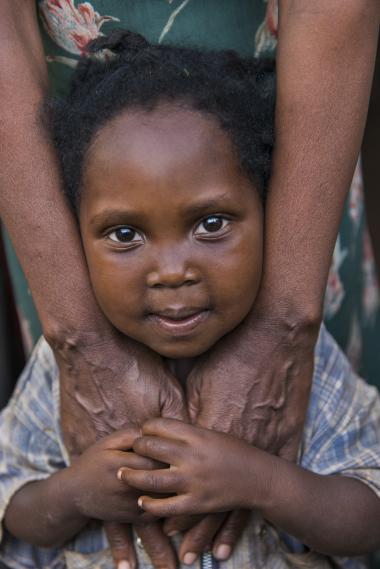 Ruth from Rwanda with her mother 